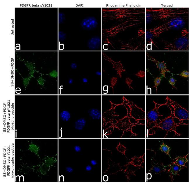 Phospho-PDGFRB (Tyr1021) Antibody