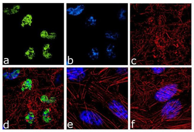 PARP1 Antibody in Immunocytochemistry (ICC/IF)