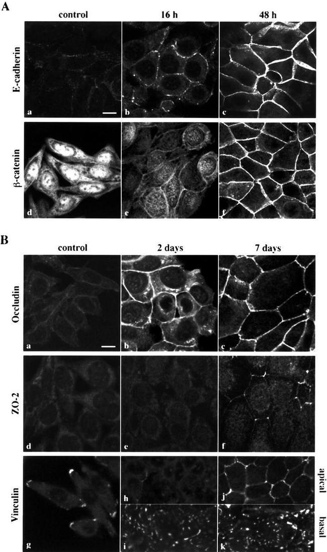 ZO-2 Antibody in Immunocytochemistry (ICC/IF)