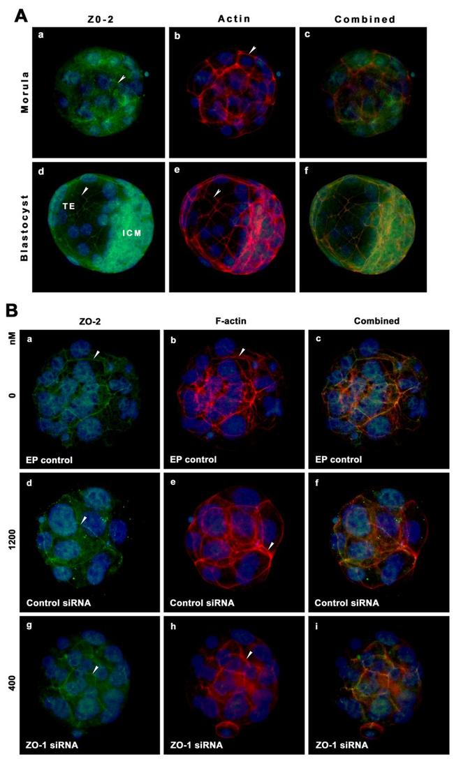 ZO-2 Antibody in Immunocytochemistry (ICC/IF)