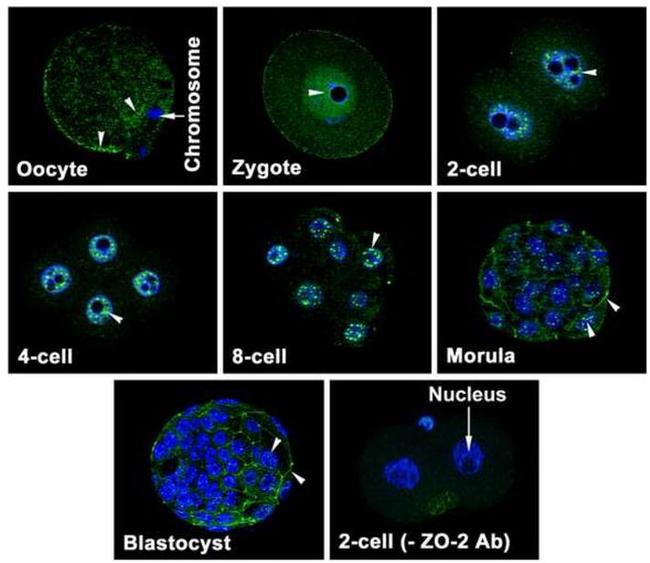 ZO-2 Antibody in Immunohistochemistry (IHC)