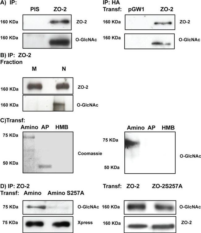 ZO-2 Antibody in Western Blot, Immunoprecipitation (WB, IP)