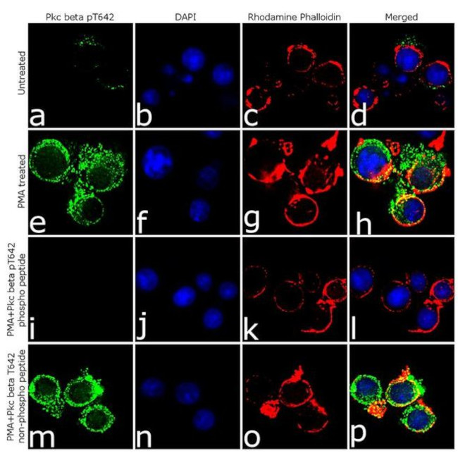 Phospho-PKC beta-1 (Thr642) Antibody in Immunocytochemistry (ICC/IF)