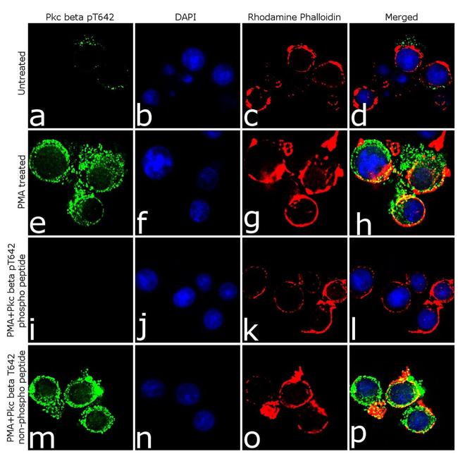 Phospho-PKC beta-1 (Thr642) Antibody