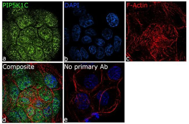 PIP5K1C Antibody in Immunocytochemistry (ICC/IF)