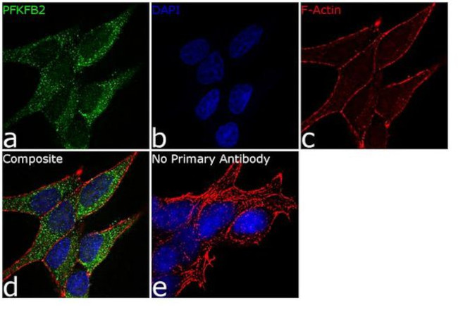 PFKFB2 Antibody in Immunocytochemistry (ICC/IF)