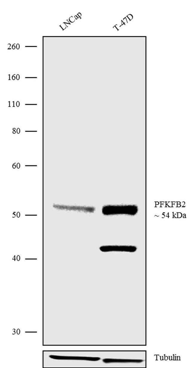 PFKFB2 Antibody in Western Blot (WB)