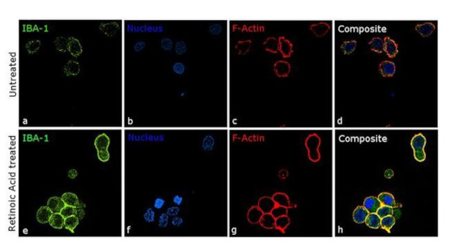 IBA1 Antibody in Immunocytochemistry (ICC/IF)