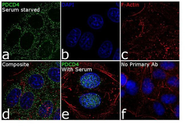 PDCD4 Antibody in Immunocytochemistry (ICC/IF)