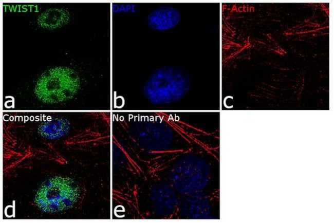 TWIST1 Antibody in Immunocytochemistry (ICC/IF)