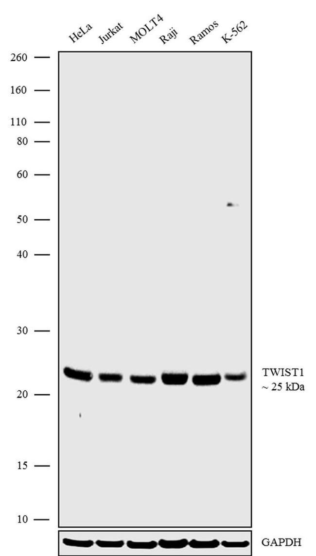 TWIST1 Antibody in Western Blot (WB)