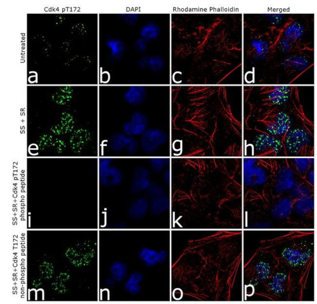 Phospho-CDK4 (Thr172) Antibody in Immunocytochemistry (ICC/IF)