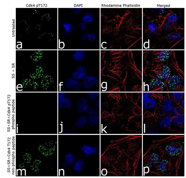 Phospho-CDK4 (Thr172) Antibody