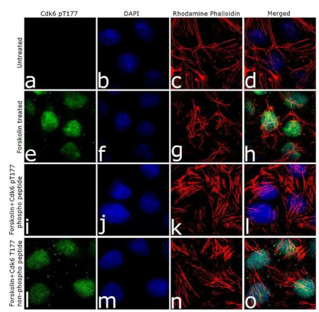 Phospho-CDK6 (Thr177) Antibody in Immunocytochemistry (ICC/IF)