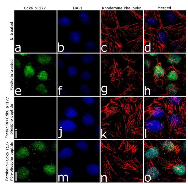 Phospho-CDK6 (Thr177) Antibody