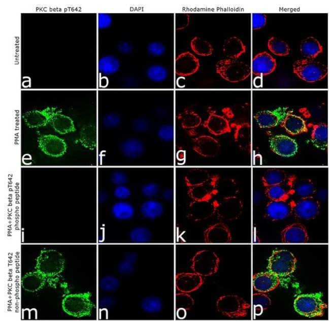 Phospho-PKC beta-1 (Thr642) Antibody in Immunocytochemistry (ICC/IF)