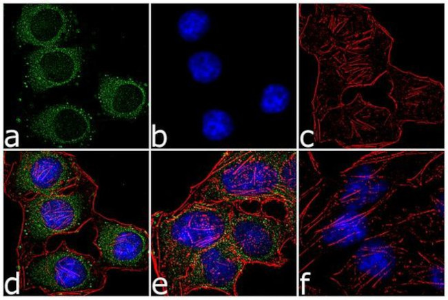 Phospho-PKA alpha/beta (Thr197) Antibody in Immunocytochemistry (ICC/IF)