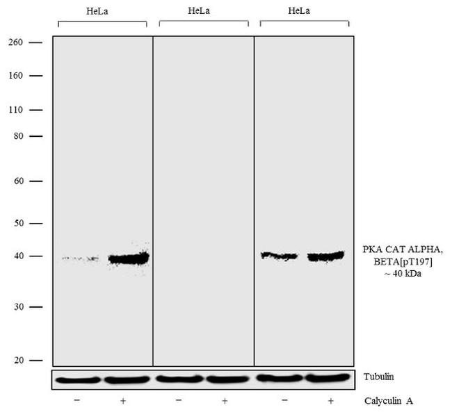 Phospho-PKA alpha/beta (Thr197) Antibody