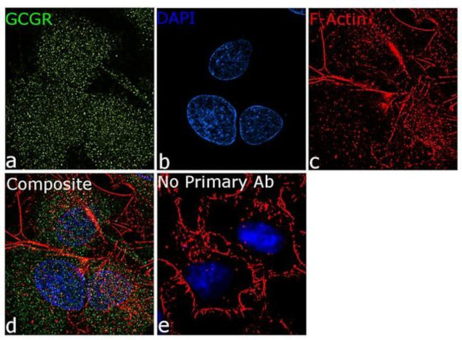 Glucagon Receptor Antibody in Immunocytochemistry (ICC/IF)