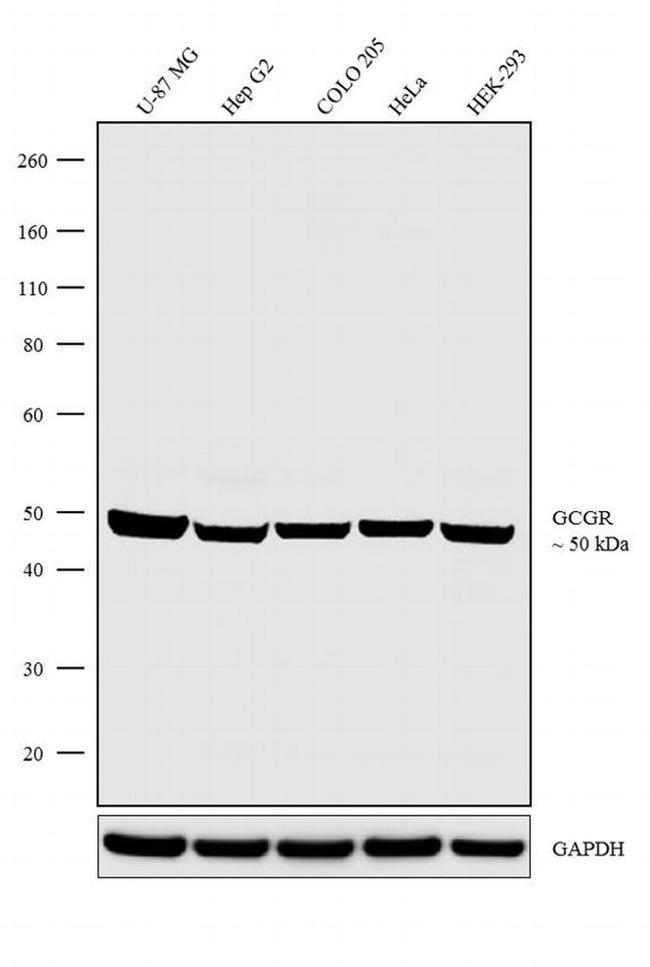 Glucagon Receptor Antibody in Western Blot (WB)