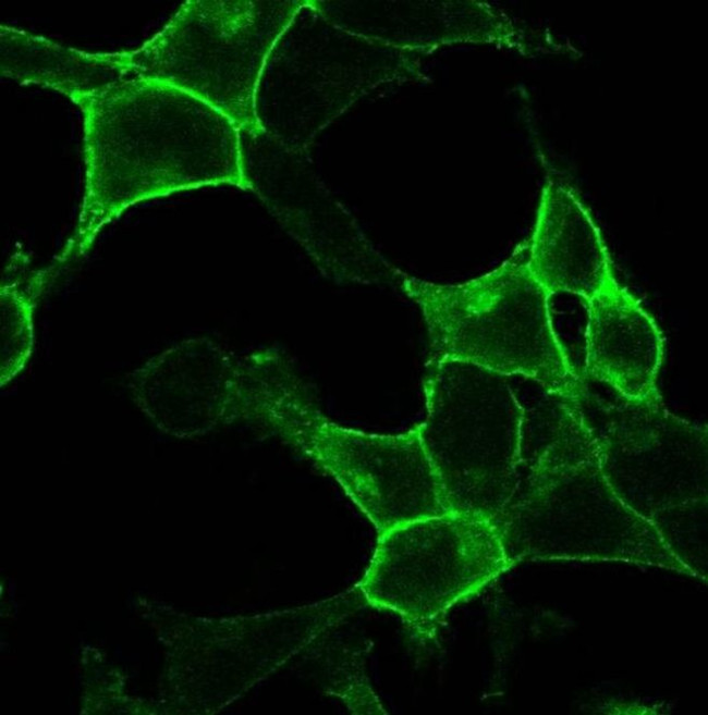 CRHR1 Antibody in Immunocytochemistry (ICC/IF)