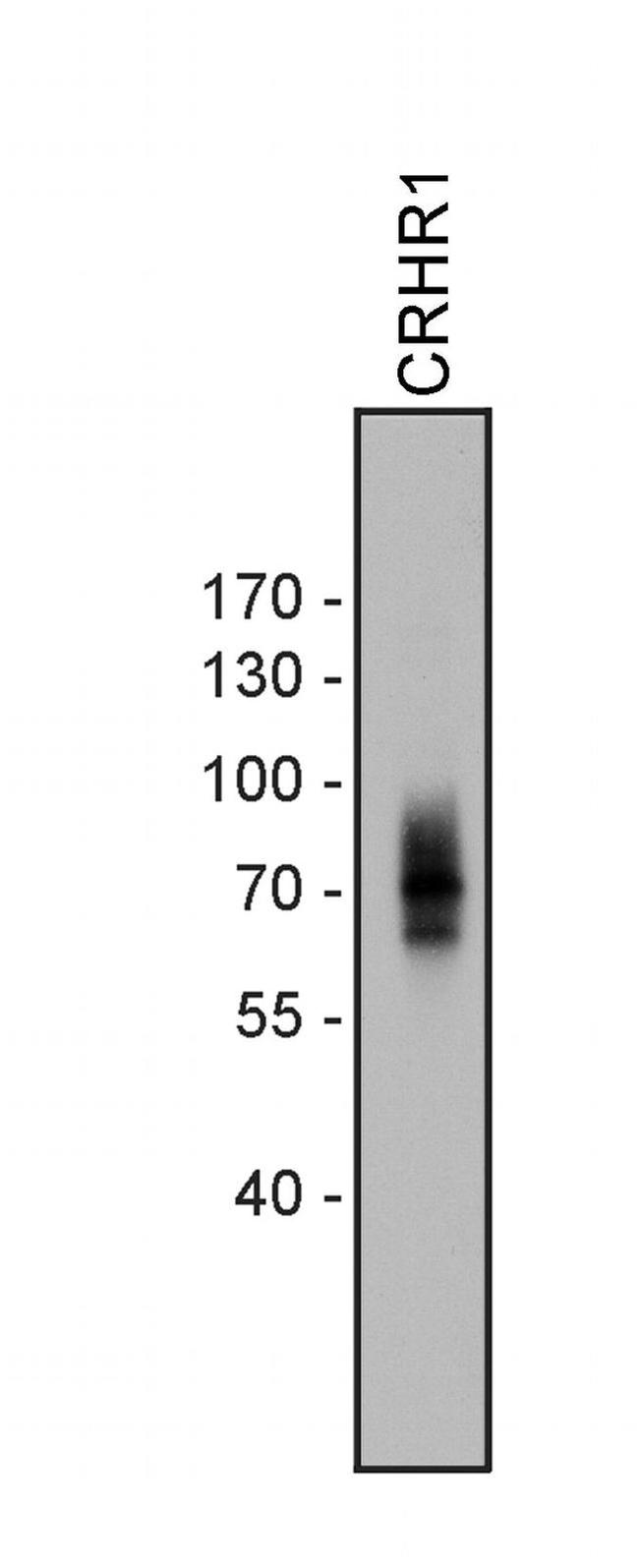 CRHR1 Antibody in Western Blot (WB)