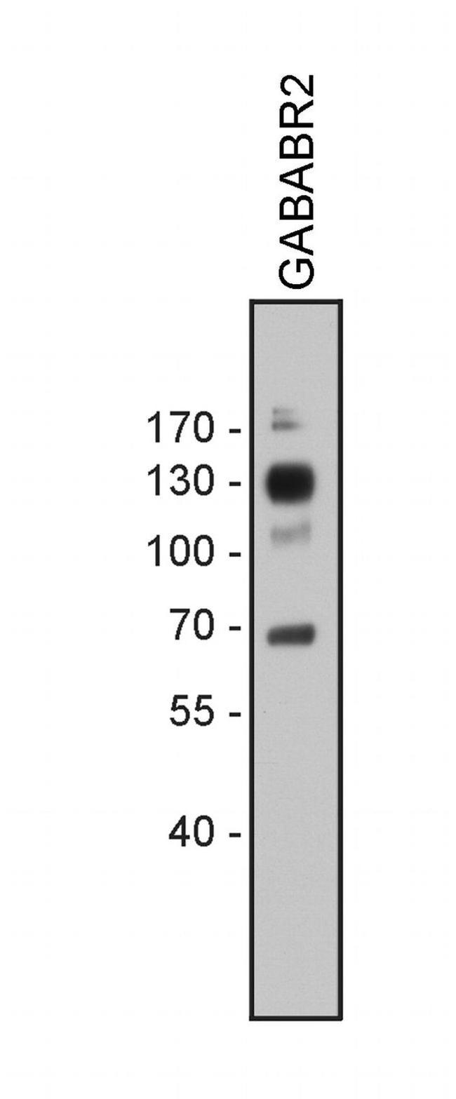 GABBR2 Antibody in Western Blot (WB)