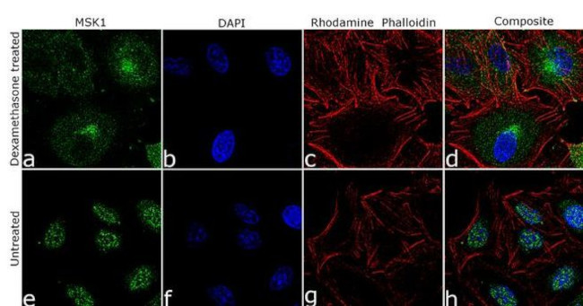 MSK1 Antibody in Immunocytochemistry (ICC/IF)