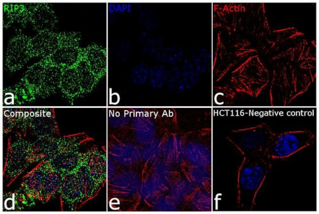 RIP3 Antibody in Immunocytochemistry (ICC/IF)