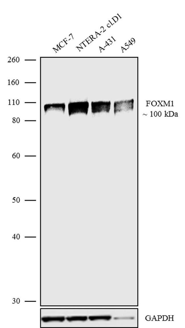 FOXM1 Antibody in Western Blot (WB)