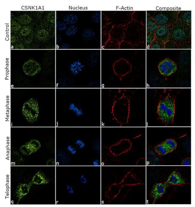 CK1 alpha Antibody in Immunocytochemistry (ICC/IF)