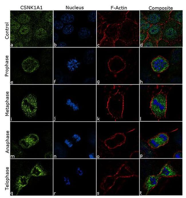 CK1 alpha Antibody