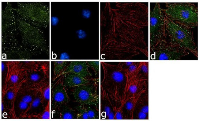 Phospho-MYL9 (Thr18, Ser19) Antibody in Immunocytochemistry (ICC/IF)