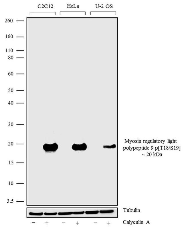 Phospho-MYL9 (Thr18, Ser19) Antibody in Western Blot (WB)