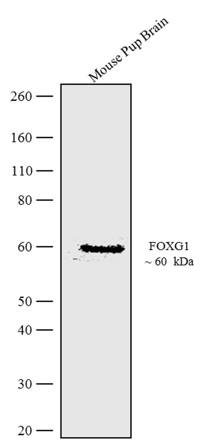 FOXG1 Antibody in Western Blot (WB)