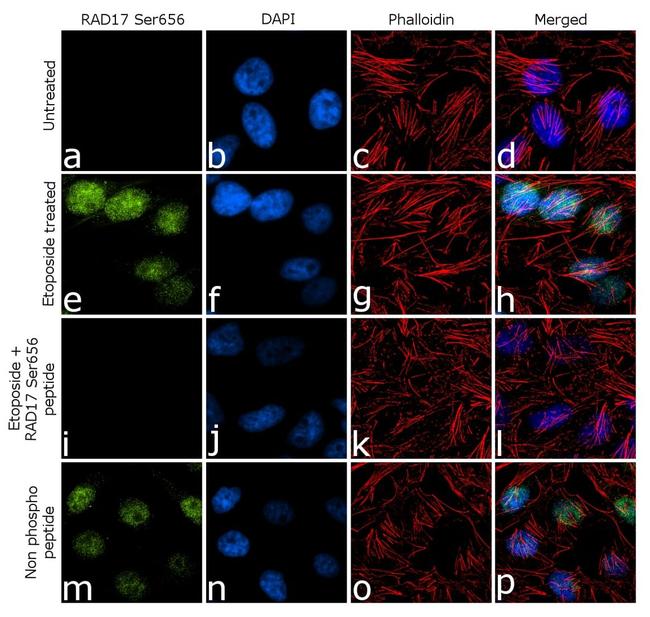 Phospho-RAD17 (Ser656) Antibody