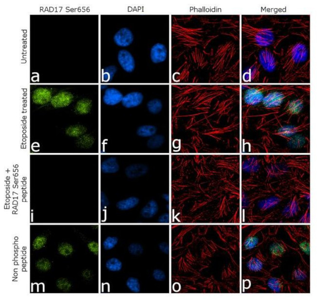 Phospho-RAD17 (Ser656) Antibody in Immunocytochemistry (ICC/IF)