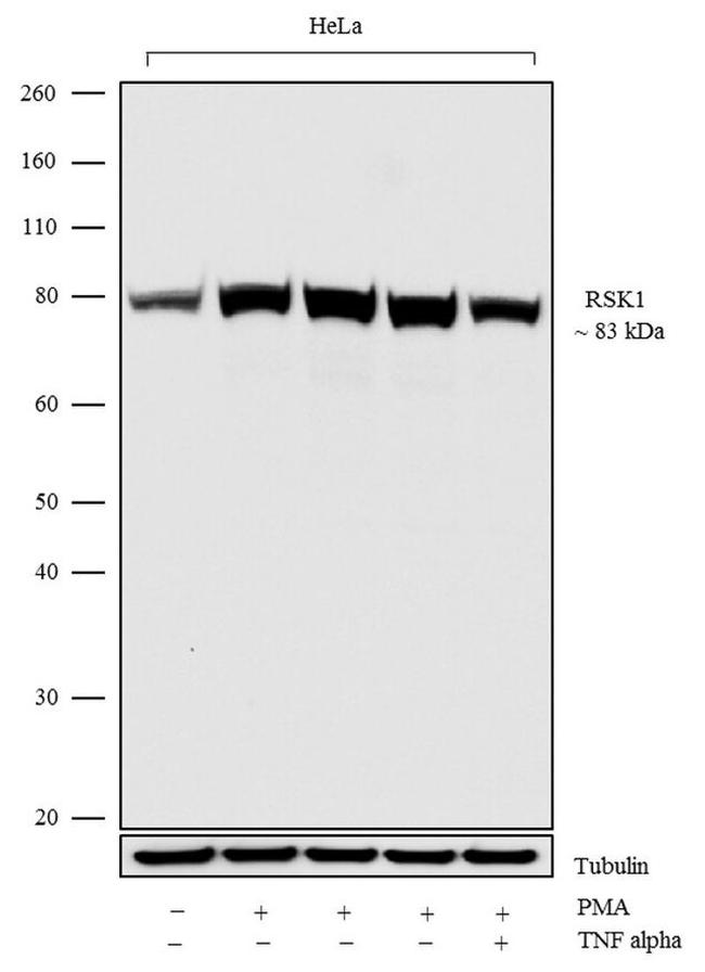 RSK1 Antibody