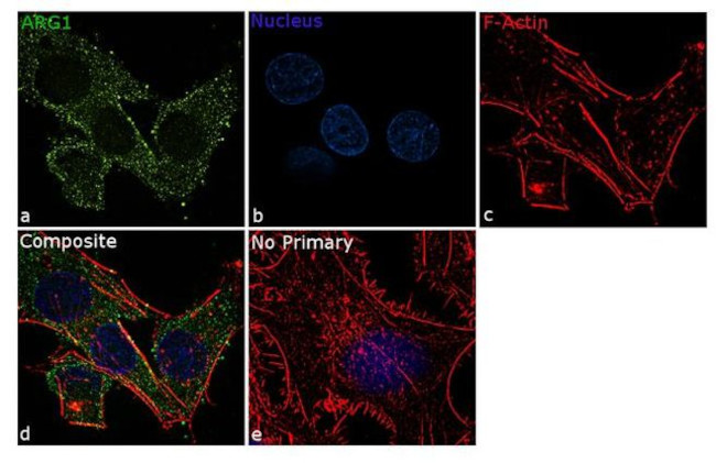 Arginase 1 Antibody in Immunocytochemistry (ICC/IF)