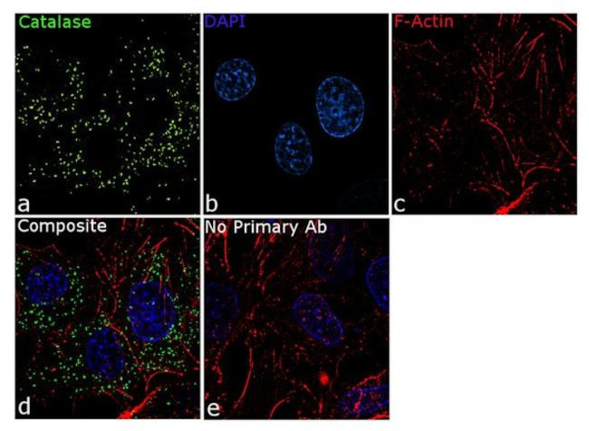 Catalase Antibody in Immunocytochemistry (ICC/IF)