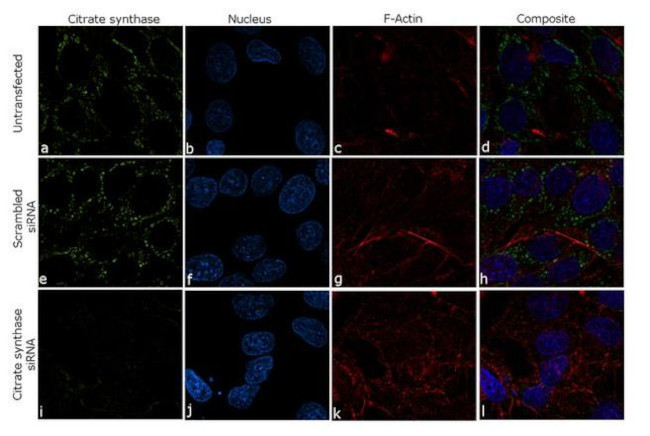 Citrate Synthase Antibody in Immunocytochemistry (ICC/IF)