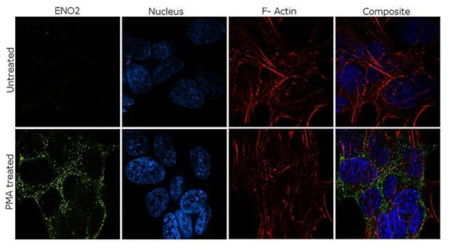 NSE Antibody in Immunocytochemistry (ICC/IF)