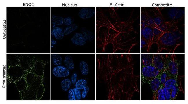 NSE Antibody