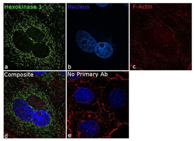 HK1 Antibody in Immunocytochemistry (ICC/IF)