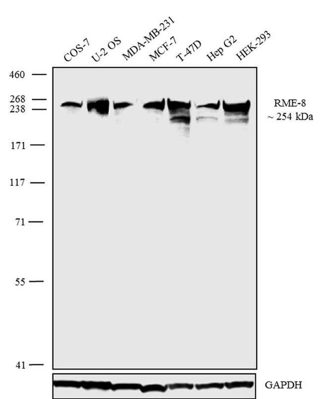 DNAJC13 Antibody in Western Blot (WB)