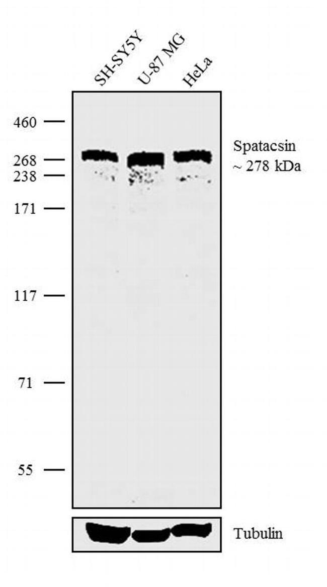 SPG11 Antibody in Western Blot (WB)