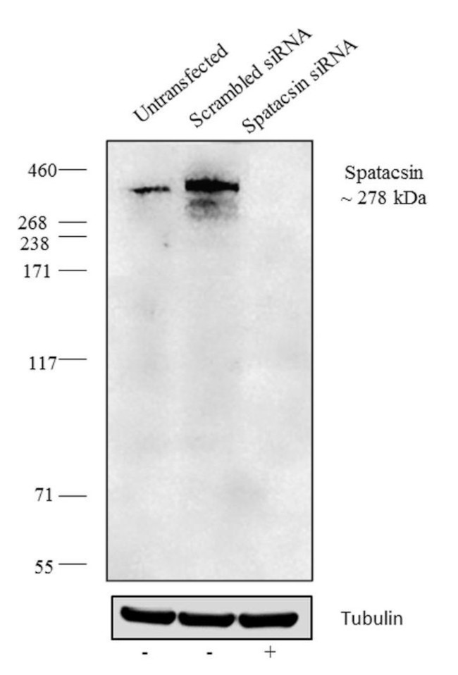 SPG11 Antibody