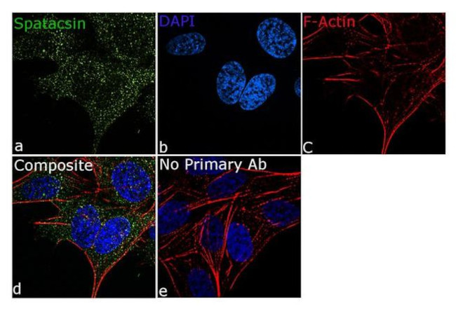 SPG11 Antibody in Immunocytochemistry (ICC/IF)