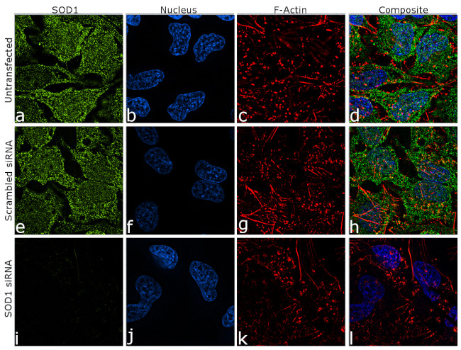 SOD1 Antibody in Immunocytochemistry (ICC/IF)