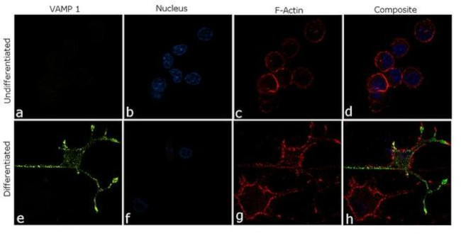 VAMP1 Antibody in Immunocytochemistry (ICC/IF)